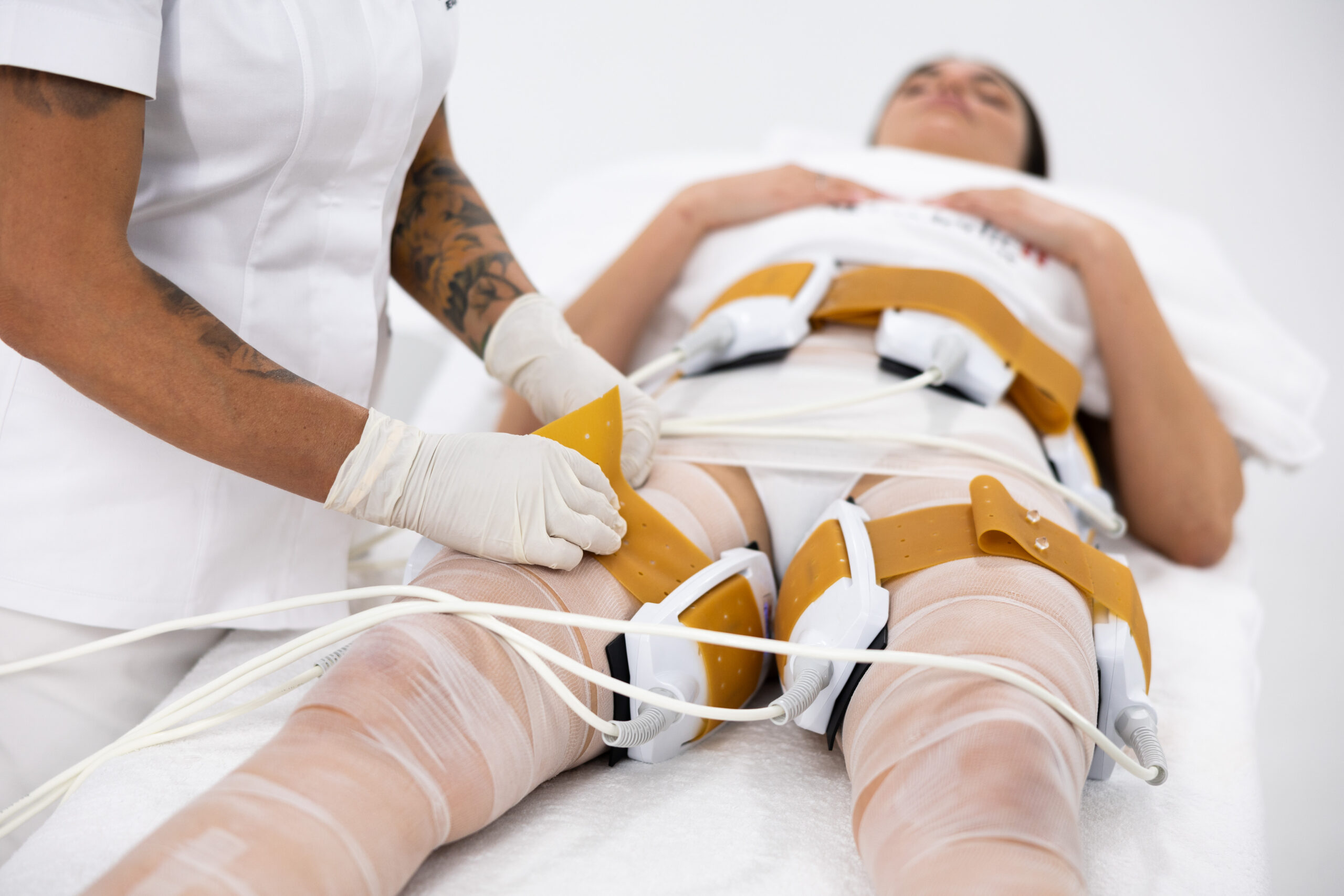 body synergy laser